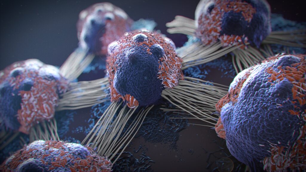 Functional Medicine Cancer Approach in Hong Kong